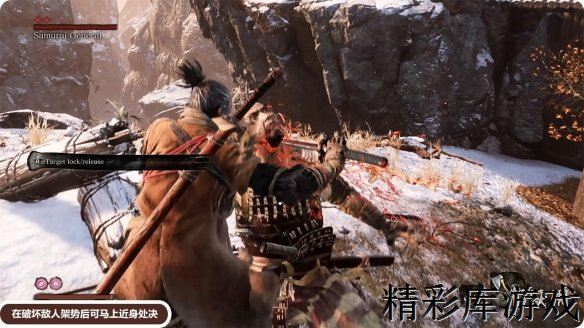 ?????影???:??XBOX??????????????? XBOX????????????? 1